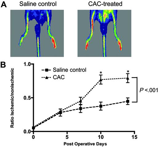Figure 4. CACs demonstrate angiogenic potential in vivo. CACs (400 000 cells) were infused intravenously into NOD/SCID β2M mice 24 hours after surgical induction of hind-limb ischemia (control, n = 5; CACs, n = 9). (A) Representative laser Doppler images at 14 days after surgery. (B) Perfusion in the ischemic hind limb relative to nonischemic hind limb was measured at the indicated time after surgery (*P < .001).