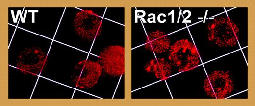 Disorganization and aggregation of actin in Rac1/2 double knock-out red cells revealed by staining for actin filaments with rhodamine-phalloidin. Grid square = 7.3 μm. See the complete figure in the article beginning on page 3637.