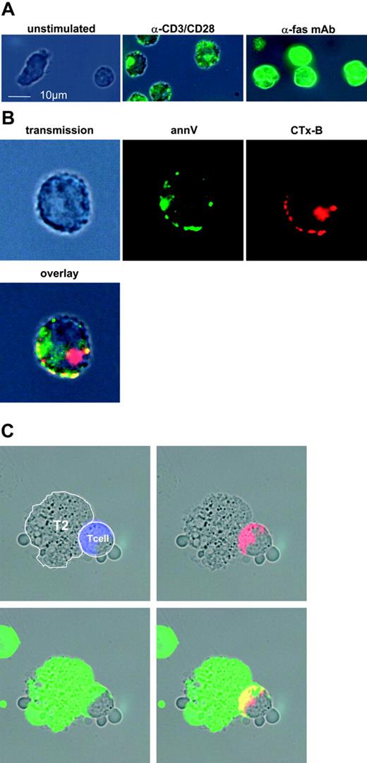 Figure 4. Fluorescence microscopy of stimulated Melan-A–specific CTLs demonstrate colocalization of exposed PS with lipid rafts. (A) Exposed PS is distributed nonhomogenously in patches. Melan-A–specific CTLs were stimulated for 4 hours with anti-CD3/CD28–coated beads (middle image) and isolated via magnetic depletion of the beads. Activated CTLs were stained with annV-FITC for 30 minutes at RT. CTLs were fixed with 2% PFA in annV-binding buffer and transferred onto poly-l-lysin–coated slides. Control CTLs were treated equally without stimulation (left image). Anti-fas mAb (clone CH-11) treated apoptotic/necrotic annVhigh CTLs are shown on the right image. (B) To detect colocalization of PS with membrane lipid rafts, CTLs were labeled with CTx-B and an anti–CTx-B–Alexa594-conjugated rabbit serum prior to annV-FITC staining. CTLs were fixed with 2% PFA in annV-binding buffer and transferred to poly-l-lysin–coated slides. Transmission light and emitted fluorescence was detected with a Zeiss Axioscope2plus microscope. An overlay of green and red fluorescence (yellow) exhibits a colocalization of PS with raft domains. (C) Melan-A–specific CTLs were preincubated with anti–MHC-I (blue) and CTx-B (lipid rafts, red) and stimulated with Melan-A–loaded T2 cells for 2 hours. AnnV-FITC (green) staining was performed and PS exposure at the immunologic synapse was visualized by overlay of fluorescence emission (yellow).