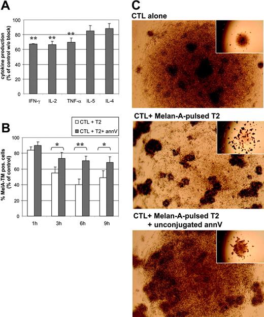 Figure 6. Inhibition of exposed PS with unconjugated annV modulates clustering of T cells. Melan-A–specific CTLs were stimulated in Ca2+-containing medium with Melan-A–loaded T2 stimulator cells in the presence or absence of 50 μg/mL unconjugated blocking annV during the assay. (A) After 5 hours of coculture, supernatants were harvested and the amount of indicated cytokines was determined by a cytokine bead array. Shown are mean values of annV-blocked samples normalized to unblocked control ± SEM; n = 5; **P < .001. (B) Cells were harvested at indicated time points, stained with Melan-A tetramer (TM), CD8-APC, annV-FITC and analyzed by FACS. Shown are mean values of blocked and unblocked CTL normalized to unstimulated CTL ± SEM; n = 4; *P < .08, **P < .01. (C) After a coculture of 24 hours, images were taken from representative unblocked (middle images) or annV-blocked (lower images) cell pellets in 96-well round bottom plates. Unstimulated CTLs (upper images) served as a control. One representative experiment of 5 is shown. Images were taken on an Axiovert25 microscope at a × 20 (insert) and × 50 magnification.