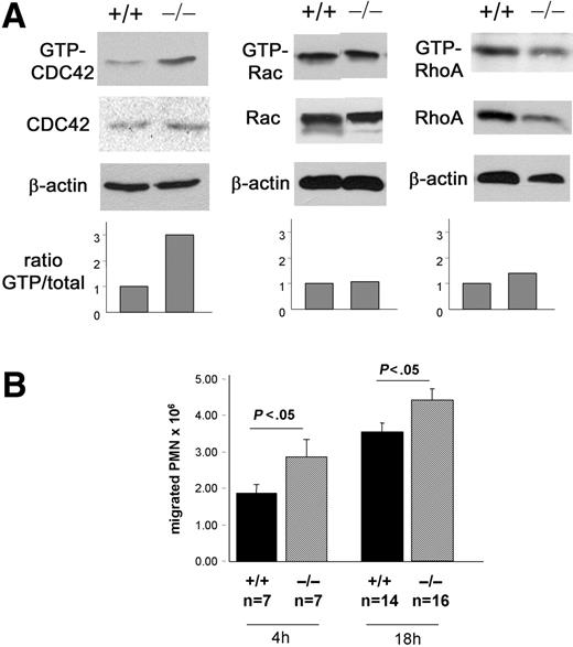 Figure 1. Model of gain of CDC42 activity. C57BL/6 cells mice reconstituted with WT or CDC42GAP–/– embryonic day (E)–14.5 fetal liver cells. The reconstituted animals were used 5 weeks after bone marrow reconstitution. (A) CDC42, Rac, and RhoA activities of bone marrow–derived neutrophils. Rho GTPase activity was assessed by the standard pull-down assay using the PAK-binding domain for CDC42 and Rac or the Rhotekin-binding domain for RhoA. The histogram represents the relative ratio of GTP-Rho GTPase versus total protein. β-actin was used as loading control. (B) Neutrophil recruitment into peritoneal cavities after challenge with 3% thioglycollate. Peritoneal lavages were performed 4 and 18 hours after challenge, and total cells were enumerated with a hemocytometer. Neutrophil content was evaluated after cytospin preparation of the cells and Diff Quick staining. Mean ± SEM from 3 independent experiments.