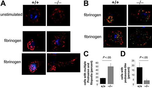 Figure 4. Loss of CDC42GAP functions is associated with abnormal assembly of podosome-like structures and filopodia. F-actin assembly and organization of adhesion structures. (A) Neutrophils were prestimulated with 10 μM fMLP and seeded on fibrinogen-coated slides for 30 minutes. The cells were then fixed and stained with rhodamine-phalloidin (in red). Figure S1 shows more representative pictures. Two representative images of each genotype from 3 independent experiments are shown. (B) Neutrophils were prestimulated with fMLP and seeded on fibrinogen-coated slides for 30 minutes. The cells were then fixed and stained with rhodamine-phalloidin (in red) and antivinculin followed by anti–mouse Alexa488 (in green). Two representative images of each genotype from 3 independent experiments are shown. (C) The percentage of cells displaying more than 1 membrane protrusion and increased filopodia was quantified. (D) The percentage of cells displaying podosome-like structures was quantified. All histograms represent the mean ± SD from 3 independent experiments.