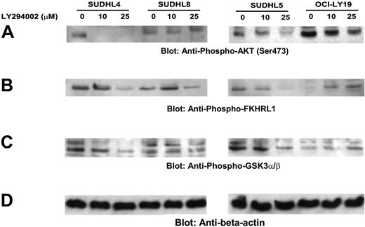 Figure 3. Inhibition of PI3K/AKT signaling pathway during LY294002-induced apoptosis. SUDHL-4, SUDHL-5, SUDHL8, and OCI-LY19 cells were treated with and without 10 and 25 μM LY294002 for 24 hours. After cell lysis equal amounts of proteins were separated by SDS-PAGE, transferred to Immobilon membrane, and immunoblotted with antibodies against phospho-AKT (Ser473), phospho FKHR, and phosphoGSK3α/β-actin as indicated.