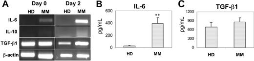 Figure 2. Expression and production of cytokines by DC progenitor cells from healthy donors (HD) and myeloma patients (MM). (A) RT-PCR detecting mRNA expression for IL-6, IL-10, and TGF-β1 in freshly isolated monocytes (day 0) and day-2–cultured cells from a healthy donor and a myeloma patient. Representative results of 4 independent experiments are shown. ELISA detecting (B) IL-6 or (C) TGF-β1 in the supernatants of day-3 cultures of the cells. Shown are the mean ± SD of the results obtained from all tested healthy donors (n = 7 for IL-6, and n = 3 for TGF-β1) and myeloma patients (n = 7 for IL-6, and n = 3 for TGF-β1). ** P values less than .01.