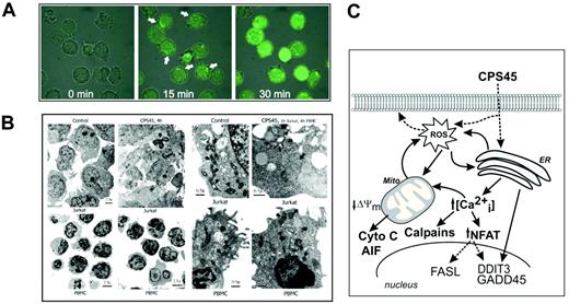Figure 7. ROS develop within minutes in an intracellular compartment in CPS45-treated leukemic cells and selectively cause damage to the mitochondria of leukemic cells. (A) Jurkat T cells were bound to poly-lysine–coated slides and preincubated with the oxidation-sensitive fluorescent dye DCFDA; fluorescence was captured by live-cell imaging on a Zeiss 510 confocal microscope (Carl Zeiss, Oberkochen, Germany) using a 100×/1.3 NA oil objective at 10-second intervals from 0 to 36 minutes after the addition of 10 μM CPS45. Captured images were annotated using Adobe Photoshop (Adobe, San Jose, CA). Arrows indicate intracellular origin of ROS in the region of the ER and associated mitochondria (Video S1). (B) Electron microscopic (EM) images of Jurkat cells (top left) and PBMCs (bottom left and bottom right) treated with 10 μM CPS45 for 4 hours. Higher magnification of Jurkat cells treated for 1 hour with CPS 10 μM 45 (top right) contrasted against PBMCs treated for 4 hours with 10 μM CPS45 (bottom right). Scale bar equals 0.5 or 2.5 μm as indicated. Arrowheads indicate mitochondria. (C) Schematic representation of the proposed mechanism of CPS45-induced cell death in leukemic cells. Entry of CPS45 initiates a cascade of molecular events beginning with elevation of ROS that originates in the ER and mitochondrial (Mito) compartment. The elevated ER stress leads to elevated calcium and subsequent NFAT induction. The ROS-induced action at the mitochondria is self-amplifying. These events culminate in mitochondrial dysfunction, elevation of stress-response genes, and cell death.