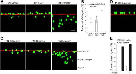 Figure 4. PMNs treated with anti-CD157 or obtained from patients with PNH show reduced transendothelial migration. (A) PMNs from healthy donors were labeled with CFSE, incubated with anti-CD157, anti-CD31, or irrelevant mAb (20 μg/mL), and seeded on TNF-α–activated HUVEC monolayers grown on collagen. After 30 minutes of migration, samples were fixed, washed, stained with anti-CD31 mAb and F(ab′)2-GαMIg-Texas red and evaluated by laser-scanning confocal microscopy (bar represents 30 μm). The images show the position of neutrophils at the end of transmigration assays. No quantitative information must be inferred. Cells were imaged using a × 60 oil immersion objective (1.4 NA). Samples were analyzed by sequential scanning of the xy planes recorded along the z-axis (step size: 1 μm). Series of confocal optical xy images were processed using a 3-dimensional reconstruction program (FluoView 300 software) and visualized as orthogonal views. (B) PMNs were seeded on TNF-α–activated HUVEC monolayers grown on fibronectin-coated transwell filters in the presence of the indicated mAb (20 μg/mL). After 1 hour of incubation at 37°C, the transmigrated cells were counted. Results are expressed as the percentage of transmigrated cells. Data are mean ± SD of 6 experiments performed in triplicate. *P < .01 anti-CD157 mAb and anti-CD31 mAb versus irrelevant IgG. (C) CFSE-labeled PMNs from patients with PNH were seeded on activated HUVECs, incubated, and analyzed as in panel A. Representative experiments from 2 PNH patients are shown. Similar results were observed in all the patients analyzed. (D) Transendothelial migration of PMNs from a representative PNH patient with recurrent bacterial infections analyzed by laser-scanning confocal microscopy, and (E) conventional transmigration assay across TNF-α–activated HUVECs monolayers grown on fibronectin-coated transwell filters. Migration is shown in the presence of a 10-nM fMLP transwell gradient. The difference between transmigration of PMNs from a PNH patient versus PMNs from healthy donor was significant, with P < .001 at any time considered.