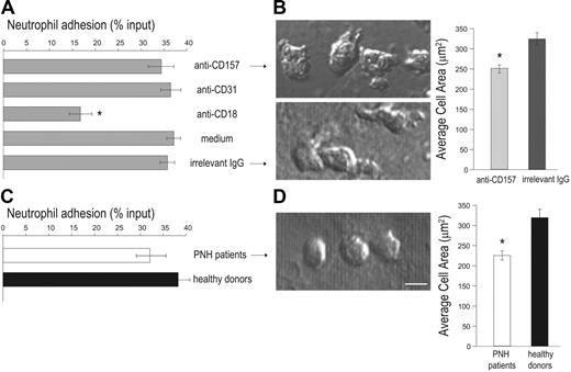 Figure 5. PMNs treated with anti-CD157 or obtained from patients with PNH show efficient adhesion to HUVECs. 51Cr-labeled PMNs from healthy donors (A) or PNH patients (C) were plated on activated HUVEC monolayers (in triplicate samples) in the presence or absence of 20 μg/mL of the indicated mAb and incubated at 37°C for 1 hour. After washing, adherent neutrophils were lysed with 2% Triton X-100 (100 μL) and the released radioactivity quantified in a γ counter. Percent specific adhesion was calculated following the formula: (51Cr released from adherent cells/total 51Cr added to each well) × 100. Results represent the mean ± SD of 3 independent experiments. *P < .001 versus all others. Comparison of cell spreading area between neutrophils treated with anti-CD157 or irrelevant IgG (B), or between neutrophils from PNH patients and healthy donors (D). PMNs were plated on HUVEC monolayers treated as described in Figure 4A-D. After 30 minutes, images were acquired by DIC using a × 60 oil immersion objective (1.4 NA; bar represents 10 μm) and analyzed by CellR Imaging software. Data are mean ± SEM of cells analyzed in 3 to 5 experiments. *P < .001.