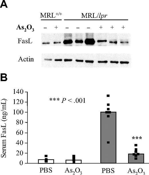 Figure 3. FasL levels return to normal in As2O3-treated MRL/lpr mice. Level of cell-surface–anchored form of FasL from 4-month-old MRL+/+ (white bars) and MRL/lpr (gray bars) mice that had been treated daily with PBS (–) or As2O3 (5 μg/g) (+) for 2 months were analyzed by Western blotting of lymphoid-cell lysates from 8 individual mice using anti-FasL mAb. The blot was stripped and reprobed with antiactin mAb. (B) ELISAs were used to determine their serum FasL concentrations. Black squares represent data from individual animals and bars correspond to the mean for 6 to 12 mice per group.