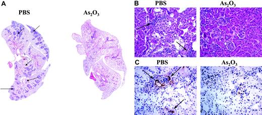 Figure 6. As2O3-induces regression of pulmonary and renal inflammatory infiltrates and inhibits immune-complex deposition in kidneys of MRL/lpr mice. Histologic examination of mononuclear-cell infiltrates (arrows) in (A) lung (original magnification ×50, with 5×/0.15 NA objective) and (B) kidney (original magnification ×200, with 20×/0.50 NA objective) sections from a 4-month-old MRL/lpr mouse that had been treated daily for 2 months with As2O3 (5 μg/g) or PBS. (C) Glomerular IgG deposits in frozen kidney sections labeled with HRP-conjugated goat anti–mouse IgG (original magnification ×200, with 20×/0.50 NA objective).