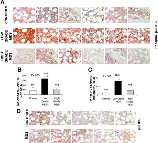 Figure 1. p38 MAPK is activated in low-grade MDS. Bone marrow (BM) biopsies from patients with MDS and control subjects with non-MDS causes of cytopenias were fixed and immunostained with antibody against phosphor-p38 MAPK (A). Histologic examination of 6 representative samples of low- and high-grade MDS and controls revealed more intense staining in low-grade MDS samples. The quantification of p-p38 staining was analyzed by counting the total number of positively stained cells (B) and by measuring intensity of the positively stained cells (C) in 5 hot fields (defined as area of high density of p-p38 staining) and aided by Image Pro Plus software. Error bars indicate SEM. Two-tailed t test shows significantly higher p38 activation per hot field in low-grade MDS samples. Differences in total p38 MAPK protein expression in 5 representative samples from each group were also evaluated in MDS and control bone marrows by immunostaining with an antibody against p38 MAPK (D).