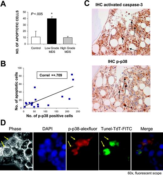 Figure 2. p38 Activation correlates with apoptosis in low-grade MDS. Bone marrow biopsies from patients with MDS and non-MDS control subjects were fixed and immunostained with antibody against cleaved or activated caspase-3. Number of apoptotic cells (cleaved caspase-3 positive) were determined in cases of low- and high-risk MDS and compared with controls. (A) Cases of low-risk MDS had significantly higher numbers of apoptotic cells (P < .05, 2 tailed t test). The number of apoptotic cells was correlated with numbers of cells positive for phospho-p38. *Statistical significance. Pearson correlation coefficient was calculated with the use of Microsoft Excel (Redman, WA) (B). Serial sections of a representative MDS bone marrow sample show that cells undergoing apoptosis exhibit greater activation of p38 MAPK (C). Bone marrow biopsies from a representative patient with MDS were stained with rabbit anti–human phospho-p38 (red) and fluorescein-TdT (green) after in situ nucleotide labeling for apoptosis detection (TUNEL assay) followed by goat anti–rabbit IgG Alexa Fluor 568 secondary antibodies. Merged immunofluorescence shows apoptotic cells exhibit activated p38 MAPK (positive for phospho-p38) (D). Arrows indicate positive cells.