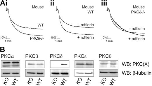 Figure 1. PKCδ negatively regulates mouse platelet aggregation in response to collagen. (A) Washed platelets were prepared from wild-type or PKCδ–/– mice and pretreated either with rottlerin (5 μM) for 15 minutes or DMSO vehicle as control. Platelet aggregation was induced with collagen (30 μg/mL) and monitored by turbidimetric aggregometry over a 10-minute period. Traces shown are representative of 3 independent experiments. (B) Whole cell lysates from PKCδ–/– and wild-type mouse platelets were analyzed for the expression of PKCα, PKCβ, PKCδ, PKCϵ, and PKCθ by immunoblotting (top panels). Uniformity of protein loading was confirmed by immunoblotting with anti–β-tubulin antibody (bottom panels). The immunoblots are representative of 3 independent experiments.