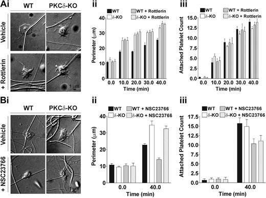 Figure 4. PKCδ negatively regulates filopodia formation in mouse platelets. (A) Washed platelets from either wild-type (WT) or PKCδ–/– (δ-KO) mice were preincubated for 15 minutes with either rottlerin (5 μM) or DMSO as control (vehicle) as indicated. Platelets were added to collagen-coated coverslips and allowed to settle on the surface and adhere to collagen fibers under static conditions. (i) Images shown are for platelets allowed to adhere to the collagen-coated surface for 40 minutes, representative of 5 independent experiments. The perimeter (ii) and number (iii) of adherent platelets were measured 0, 10, 20, 30, or 40 minutes after being dispensed onto the collagen-coated surface. In the absence of rottlerin, the differences in perimeter (at 10, 20, 30, and 40 minutes) between WT and PKCδ–/– (δ-KO) platelets were statistically significant (P < .01), while no significant difference was detected (P > .05) for the number of adherent platelets. In the presence of rottlerin, the difference in perimeter between PKCδ–/– (δ-KO) and WT platelets was not significant (P > .05). Data shown are mean ± SEM from 3 independent experiments. (B) Washed platelets from either wild-type (WT) or PKCδ–/– (δ-KO) mice were preincubated for 15 minutes with either NSC23766 (200 μM) or DMSO as control (vehicle) as indicated. Platelets were added to collagen-coated coverslips and allowed to settle on the surface and adhere to collagen fibers under static conditions. (i) Images shown are for platelets allowed to adhere to the collagen-coated surface for 40 minutes, representative of 3 independent experiments. The perimeter (ii) and number (iii) of adherent platelets were measured 0 and 40 minutes after being dispensed onto the collagen-coated surface. The differences in perimeter between WT or PKCδ–/– (δ-KO) platelets at 40 minutes were statistically significant in the presence or absence of NSC23766 (P < .01). Values shown are mean ± SEM from 3 independent experiments, and the statistical differences were analyzed by 1-way ANOVA.