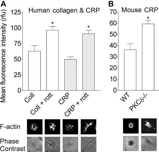 Figure 5. PKCδ negatively regulates actin polymerization in platelets. (A) F-actin quantification in human platelets adherent to collagen-coated or CRP-coated surfaces in the absence or presence of rottlerin (5 μM). (B) Wild-type (WT) or PKCδ–/– mouse platelets adherent to CRP-coated surfaces. Platelets were fixed 40 minutes after addition to the coated surfaces, permeabilized, and stained with TRITC-phalloidin. Fluorescence labeling was detected by confocal microscopy and quantified using Leica Confocal Software. Data represent mean ± SEM (n = 4), and the statistical significance of difference was analyzed by 1-way ANOVA (*P < .01, comparison between results in the absence or presence of rottlerin or between WT and PKCδ–/– mouse platelets). Images below the graphs show representative examples of platelets obtained under the same conditions indicated in the bar graph and stained with TRITC-phalloidin (top row), with corresponding phase-contrast images (bottom row).