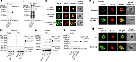 Figure 6. Physical and functional association of PKCδ with VASP. (A) Washed human platelets were stimulated for 180 seconds with collagen (30 μg/mL) or unstimulated (vehicle). Reactions were stopped by addition of ice-cold NP-40 lysis buffer, and PKCδ (i) or VASP (ii) was immunoprecipitated and blotted each for PKCδ and VASP as indicated. The arrows indicate the molecular weight of VASP (i) or PKCδ (ii). The immunoblots are representative of 3 independent experiments. (B) Human platelets adherent to a CRP-coated surface were fixed, permeabilized, and immunostained with 1:250 anti-VASP and 1 μg/mL anti-PKCδ antibodies. VASP and PKCδ were then detected using FITC-conjugated anti–rabbit IgG antibody and TRITC-labeled anti–mouse IgG antibody, respectively. Images shown are the distribution of VASP (left column), the distribution of PKCδ (second column), and their superimposition (third column) from 3 independent experiments. The phase-contrast image of the platelet is also shown (right column). The early stage of platelet attachment, the transient filopodial phase, and the late lamellipodial phase are represented on the top, center, and bottom rows, respectively. (C) Whole cell lysates (WCL) of (i) human platelets or (ii) platelets from either wild-type or PKCδ–/– mice were immunoblotted with 1:1000 anti–phospho-VASP (Ser157) and 1:1000 anti–phospho-VASP (Ser239) (top and middle panels, respectively). Bottom panels show the reblot with 1:1000 anti-VASP antibody. Platelets were either nonstimulated or stimulated with CRP (5 μg/mL) or collagen (30 μg/mL) in the absence or presence of rottlerin (5 μM, 15 minutes of preincubation) as indicated. The arrow indicates the molecular weight of VASP. All immunoblots shown are representative of 3 independent experiments. (D) Human platelets were either nonstimulated or stimulated with collagen (30 μg/mL) in the absence or presence of kinase inhibitors (H89, 3 μM; or Gö6976, 1 μM; 15 minutes of preincubation) as indicated. Whole cell lysates (WCL) were immunoblotted with 1:1000 anti–phospho-VASP (Ser157) and reprobed with 1:1000 anti-VASP antibody (top and bottom panels, respectively). The arrow indicates the molecular weight of VASP. All immunoblots shown are representative of 3 independent experiments. (Ei) Human platelets adherent to collagen or (ii) platelets from either wild-type or PKCδ–/– mice adherent to CRP were immunostained with 1:250 anti-VASP antibody and 2 μg/mL TRITC-phalloidin and then with FITC-conjugated anti–rabbit IgG antibody. (i) Distribution of VASP (left column) and F-actin (second column) in human platelets in the absence (top panels) or presence (bottom panels) of rottlerin (5 μM, 15 minutes of preincubation). (ii) Distribution of the same proteins in platelets derived from wild-type (WT, top panels) or PKCδ–/– (bottom panels) mice. The superimposition of VASP and F-actin labeling (third column) and the phase-contrast image (right) are also shown. Images shown are representative of 3 independent experiments.