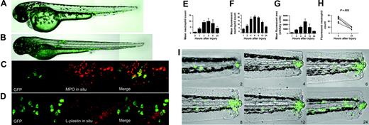 Figure 1. The MPO::GFP construct drives fluorescent protein expression in neutrophils, which participate in a spontaneously resolving inflammatory response to injury. Zebrafish larvae were anesthetized by the addition of 4.2% tricaine to the medium in which they were maintained (E3). GFP was visualized by excitation at 492 nm. All photomicrographs were taken under air immersion using either 10×/0.3 NA or 20× ELWD/0.45 NA Plan Fluor objectives. No nonlinear normalization was performed. Confocal images (C, D) were taken using a 60×/1.40 NA oil immersion Plan Apo objective. (A-B) Photomicrographs of larvae at 56 and 96 hours show expression of GFP over the first days of zebrafish myelopoiesis. (C) Summed Z stacks of consecutive images through the intermediate cell mass (ICM) of a day 3 transgenic zebrafish stained by in situ hybridization for MPO and by immunohistochemistry for GFP. Images taken through the Alexa-488 and TRITC channels are shown, followed by a merged image. In all GFP-positive cells (green), some MPO in situ signal (red) can be seen. Examination of individual sections confirms colocalization of these markers. (D) Summed Z stacks of consecutive images through the ICM of a day 3 transgenic zebrafish stained by in situ hybridization for L-plastin and by immunohistochemistry for GFP. Images taken through the Alexa-488 and TRITC channels are shown, followed by a merged image. GFP-positive cells (green) do not coexpress L-plastin (red). Examination of individual sections confirms absence of colocalization of these markers. (E) Tailfins of anesthetized wild-type AB zebrafish were transected at 4 days after fertilization. At the time points indicated, fish were anesthetized, then fixed and stained as described in “Materials and methods.” The number of neutrophils participating in the inflammatory response (excluding cells in the posterior blood island) was assessed. Data shown are mean ± SEM, n = 3, with 5 replicates per experiment. (F) Tailfins of anesthetized transgenic zebrafish were transected at 4 days after fertilization. At the time points indicated, individual fish were anesthetized and imaged as described. The number of fluorescent neutrophils participating in the inflammatory response was assessed. Data shown are mean ± SEM (n = 5). (G) Images taken for the counts shown in panel E were processed (IPlab) to quantify the total area of fluorescence. For each image, a series of fluorescence images in Z were projected into a single image using the maximum intensity at each point. These images were normalized, and a region of interest was defined corresponding to the area of inflammation quantitated. Segmentation of this region was performed in IPlab, and the area of fluorescence was exported to Excel. The procedure was automated by use of an IPlab script. (H) Fluorescence counts of individual larvae at 6 and 24 hours after injury (hpi) are shown. The individual pattern of resolution is evident for each fish. (I) Images showing a single transgenic zebrafish larva at the time points indicated (hpi). The accumulation of fluorescent cells and their subsequent removal can be clearly seen.