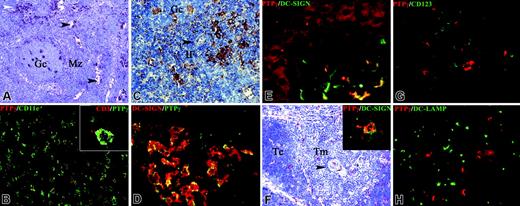 Figure 2. PTPγ expression in lymphoid organs and skin. Sections were obtained from spleen (A), human tonsil (B), lymph node (C-D), skin (E), and thymus (F-H). In the spleen, PTPγ+ stained tingible body macrophages of a B-cell follicle and macrophages (white arrowhead) and sinus lining cells (black arrowheads) in the red pulp (A;Gc indicates germinal center; Mz: marginal zone). Double immunofluorescence staining shows that all PTPγ+ found in the B-cell follicle coexpressed CD11c on the plasma membrane (B), and some of them clustered with CD3+ germinal center T-cells (B, inset). PTPγ+ cells with dendritic morphology are obvious in the interfollicular (IF) area, highlighted by the presence of high endothelial venules (C, black arrowhead) and in most DC-SIGN+ sinus macrophages (D, yellow cells). In normal skin, PTPγ++ positivity was diffuse in the epidermis; in the dermis, scattered PTPγ++ cells were observed, most of which showed an irregular morphology and coexpressed DC-SIGN (E, yellow cells). In normal thymus, scattered PTPγ++ cells were observed in the cortex (Tc) and in the medulla (Tm) (F), highlighted by the presence of Hassal bodies (arrowhead); no reactivity was observed on most thymocytes (F-H). PTPγ++ cells were irregular in morphology and showed abundant cytoplasm (F-H), and some of them coexpressed DC-SIGN (F, inset). PTPγ positivity was absent on CD123+ plasmacytoid dendritic cells (G) and in DC-LAMP+ mature dendritic cells (H) populating the thymic medulla. Indirect immunoperoxidase technique was applied, and nuclei were counterstained with hematoxylin (A, C, F). Double immunofluorescence was performed using FITC- and Texas red–conjugated secondary antibodies, as labeled (B, D-E, G-H).