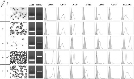 Figure 3. PTPγ expression is differentially modulated by IL-4 and GM-CSF. IL-4 and GM-CSF were added, either individually or in combination, at the beginning of incubation. *IL-4 was added after 3 days of GM-CSF treatment. Some of the cells were stained with May-Grunwald; the remaining cells were analyzed by cytofluorometry with a combination of myeloid markers. Large cells with large, vacuolated cytoplasm are shown in the absence of cytokines. These cells did not express PTPγ and were characterized by a macrophage phenotype (CD14+CD64+CD1a–CD80–). PTPγ began to be expressed only when IL-4 was added, but in the absence of GM-CSF the number of cells obtained in culture was decreased and the phenotype was macrophagic. When both cytokines were added, PTPγ was expressed, and both the morphology and the surface markers shifted to those of a typical DC phenotype (CD14–CD64–CD1a+CD80+). If IL-4 addition was delayed (*), the phenotype was intermediate because CD64 was still expressed and the cytoplasmic processes typical of DCs were less apparent. ACTB expression demonstrated the specificity of the signal. Results of 1 of 3 representative experiments are shown. Shaded areas represent isotype control; open areas, the specific marker.