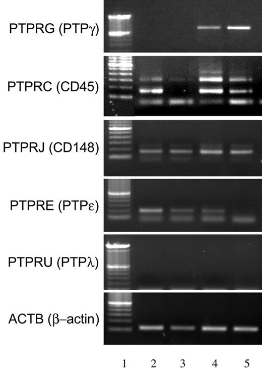 Figure 5. PTPγ regulation is unique among other RPTPs. Expression of PTPγ mRNA in comparison with a selection of RPTPs in resting and activated moMΦ and moDCs. Lane 1, marker; lane 2, resting macrophages; lane 3, macrophages activated with 100 ng/mL LPS for 24 hours; lane 4, resting DCs; lane 5, DCs activated with 100 ng/mL LPS for 24 hours. Names of the genes analyzed appear on the left side of the picture.
