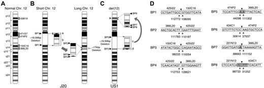 Figure 1. Chromosomal abnormalities in 2 patients with PNH. (A) Idiogram of normal chromosome 12 (Chr 12) modified from the NCBI Map viewer. Labeled gray boxes indicate the positions of the designated BAC clones used for FISH analysis. (B) J20. The karyotypic abnormality identified in the GPI-AP– bone marrow cells of J20 was defined as an interchromosomal insertion. An 18.5M-bp region from q12 to q14 (surrounded by broken lines) is deleted in short chromosome 12 as defined by characterization of BP1. The 2.7-kbp small fragment (bracketed arrowhead, labeled a) and the 18.5-Mbp large fragment (bracketed rectangle, labeled b) deleted from short chromosome 12 are inserted inversely and directly, respectively, into the 12q14 region of long chromosome 12 generating BP2, BP3, and BP4. The deleted region into which the 2 fragments are inserted lacks 17 kbp of sequence (broken lines). BP1, BP2, BP3, and BP4 indicate the breakpoint junctions generated by the chromosomal abnormality. (C) US1. The karyotypic abnormality identified in the bone marrow cells of US1 was defined as an intrachromosomal insertion. The large fragment (19.5 Mbp, labeled c) and the small fragment (300 kbp, labeled d) are inserted into the TEL locus (gray arrowhead) on 12p13. BP5 is generated by the deleted region. BP6, BP7, and BP8 are generated by rearranged fragments c and d. (D) Sequences of BP junctions in J20 and US1. The sequences around BP junctions 1 to 8 are shown. BAC clones containing the sequence are denoted above the lines. Arrows indicate the nucleotide numbers of the BAC clones. Arrowheads indicate one of the candidate breakpoints, and gray regions indicate ambiguous sequences shared between the 2 BAC clones at the site of the breakpoint.