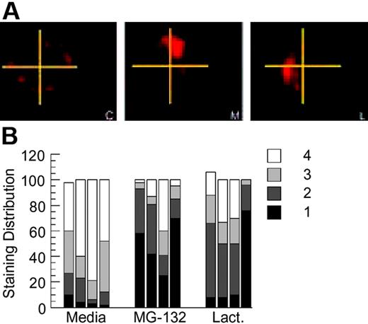 Figure 6. Proteasome inhibition alters the intracellular distribution of persisting antigen-BCR complexes. (A) MD4.B10.Br splenocytes were pretreated with the indicated inhibitor for 1 hour at 37°C before pulsing with antigen (100 nM HEL) for 4 hours. The cells were then washed (to remove both antigen and drug) and cultured for an additional 18 to 20 hours at 37°C. The cells were then collected, fixed, and stained for persisting Ag-BCR complexes using the 2D1 anti-HEL mAb.11,14 C indicates control, non–drug-treated cells; M, MG-132–treated cells; and L, lactacystin-treated cells. Shown are representative images from 1 of 4 independent experiments. (B) For each experimental condition, 100 B cells were visualized and the distribution of persisting antigen was scored as described in “Material and methods.” Shown is the frequency of cells in which the persisting Ag-BCR complexes were detected in 1, 2, 3, or 4 quadrants of the cell. Each bar represents the results from a single independent experiment.