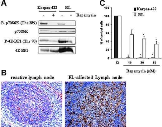 Figure 1. mTOR activity in cells and tissue derived from FL. (A) FL cell lines (Karpas-422 and RL) were treated or not with rapamycin at 10 nM for 24 hours, then mTOR activity was evaluated by Western blotting using antiphospho-p70S6K and phospho-4E-BP1 antibodies. p70S6K and 4E-BP1 were used as controls of protein expression. Results are representative of 3 independent experiments. (B) mTOR activity was evaluated in FL lymph node sections by immunohistochemistry using an antiphospho-p70S6K antibody as described in “Materials and methods.” This result is representative of the 6 positive samples analyzed. Objective magnification 20×/0.5 NA. (C) Clonogenicity of FL cells treated or not with rapamycin at various doses was measured after 7 days in methylcellulose medium as described in “Materials and methods.” CT corresponds to untreated FL cells, and results are the mean ± SD of 3 independent experiments. * P < .01.