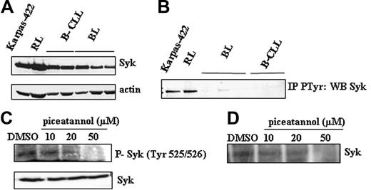 Figure 3. Status of Syk in FL cells. (A) Syk expression was visualized by Western blotting in FL cell lines and compared to B cells isolated from B-CLL patients (B-CLL) and healthy donors (BL). Actin was used as control of protein expression. Results are representative of 3 independent experiments. (B) Syk activity was evaluated by P-Tyr immunoprecipitation followed by Western blotting using an anti-Syk antibody, in FL cells and B cells isolated from healthy donors (BL) and from B-CLL patients (B-CLL). Results are representative of 3 independent experiments. (C) Effect of piceatannol on Syk activity was evaluated in Karpas-422 cells by Western blotting using an antiphospho-Syk antibody specific to tyrosine 525/526 residue. Results are representative of 3 independent experiments. (D) Effect of piceatannol on Syk activity was evaluated in RL cells by immunokinase assay as described in “Materials and methods.” Results are representative of 3 independent experiments.