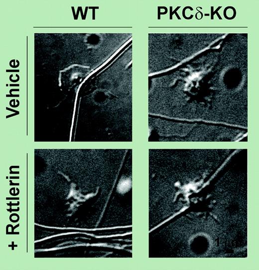 PKCδ negatively regulates filopodia formation in human platelets. See the complete figure in the article beginning on page 4035.