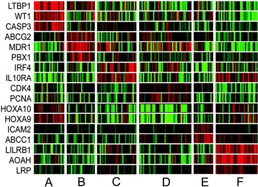 Figure 7. Differential expression of select genes among VxInsight clusters. The columns represent the 170 AML samples ordered by VxInsight membership. Rows represent select genes that are differentially expressed among the VxInsight clusters. Red indicates high expression relative to the mean; green, low expression relative to the mean.