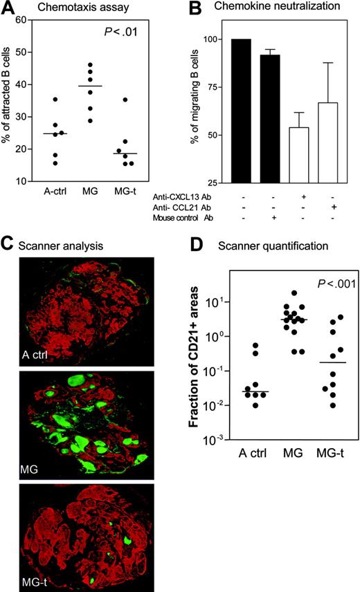 Figure 3. Effect of glucocorticoids on GCs. (A) Specific chemoattraction of normal B cells by thymus extracts from adult controls (A ctrl), MG untreated (MG), and MG glucocorticoid-treated patients (MG-t). Each dot represents one sample after subtracting the spontaneous migration. (B) Four thymic extracts from MG patients used in panel A were incubated alone or with addition of anti-CXCL13, anti-CCL21, or mouse control antibody. The results are expressed as the mean and SEM. (C) Immunohistochemical analysis on thymic sections from A ctrl, MG, and MG-t patients (magnification, 5×). In red, epithelial network stained with antikeratin antibody; in green, FDC and B cells stained with anti-CD21 antibody. The whole sections were scanned using a microarray scanner. (D) Quantification of CD21 expression in the thymus of A ctrl, MG, and MG-t patients using Image J software. The P value was obtained by the nonparametric one-way analysis of variance (Kruskal-Wallis test). The horizontal lines in panels A and D represent the median value.