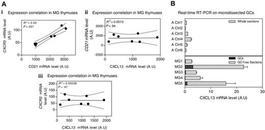 Figure 4. Source of CXCL13 in the thymus of MG patients. (A) Correlation between CXCR5 and CD21 mRNA levels (i), CXCL13 and CD21 mRNA levels (ii), and CXCL13 and CXCR5 mRNA levels (iii) in samples from MG untreated patient thymuses. The R2 and P value were obtained by the nonparametric correlation test (Spearman test). (B) Amplification of CXCL13 gene by real-time RT-PCR on total sections from 6 adult controls (Ctl1-6), 5 thymic GC-free sections from untreated MG patients (MG1-5), and their corresponding microdissected GCs. RT-PCR was performed in duplicate. Error bars represent the mean value of the 2 duplicates ± SEM.