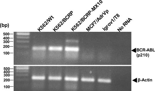 Figure 3. RT-PCR for p210 BCR-ABL. RT-PCR products from the indicated cells were visualized in 2% agarose gel, along with a 100-bp DNA ladder.