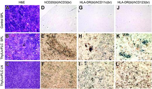 Figure 2. Immune-cell population and structural reconstitution of spleen and lymph nodes in NOD/SCID mice that received human Thy/Liv/CD34+ FLCs. Spleens and lymph nodes were harvested from control NOD/SCID mice (n = 6) and NOD/SCID mice that received human Thy/Liv/CD34+ FLCs at death between 18 and 25 weeks after human tissue/cell transplantation (n = 5), and assessed by H&E and immunohistochemical staining. (A-C) H&E staining of representative spleen samples from control NOD/SCID mice (A) and NOD/SCID mice that received Thy/Liv/CD34+ FLCs (B, arrow indicates a central artery), and mesenteric lymph node (C) from NOD/SCID mice that received Thy/Liv/CD34+ FLCs (original magnification, × 200). (D-L) Immunohistochemical staining of representative spleen sections from control NOD/SCID mice (D,G,J) and NOD/SCID mice that received a graft of Thy/Liv/CD34+ FLCs (E,H,K), and mesenteric lymph node sections from NOD/SCID mice that received a graft of Thy/Liv/CD34+ FLCs (F,I,L). Shown are results of 2-color immunohistochemistry with anti–human CD20 (blue) and anti–human CD3 (brown) (D-F; original magnification, × 200), anti–HLA-DR (blue) and anti–human CD11c (brown) (G-I; original magnification, × 400), or anti–HLA-DR (blue) and anti–human CD123 (brown) (J-L; original magnification, × 400). bl indicates blue; br, brown.