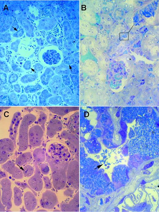 Figure 3. Transgenic mice kidneys by light microscopy. (A-B) Homozygous κ-CHEB mice. Semithin sections of araldite-included samples. Toluidine blue staining, original magnification × 100 (A) and × 400 (B). Numerous crystalline inclusions in the cytoplasm of proximal tubular cells (arrows and inset). Note the absence of myeloma casts in distal tubule lumens (A), and the normal appearance of glomerular tufts and Bowman capsules (A-B). Crystalline inclusions were not observed in the initial part of proximal tubules (B, asterisk). (C) κ-CHEB/κ-del mice. Semithin sections of araldite-included samples. Toluidine blue staining, original magnification × 400. Few crystalline inclusions were present within proximal tubules (arrow). (D) Patient CHEB. Araldite-inclusion, toluidine blue staining, original magnification × 1000. Massive cytoplasmic crystalline accumulation in proximal tubular cells, with some free crystals in tubular lumen (arrow). Inclusions were not observed in glomeruli.