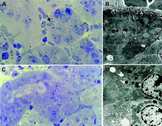 Figure 7. Effect of κCHEB LC conditional deletion on renal morphology. (A-B) κ-CHEB/κ-del mouse, left nephrectomy, performed before pI-pC-induced VκJκ CHEB deletion. (A) Light microscopy, araldite inclusion, toluidine blue staining, oil immersion (original magnification × 1000). (B) Electron microscopy (original magnification × 5000). Numerous crystalline inclusions within the cytoplasm of proximal tubular cells (arrows). (C-D). Same κ-CHEB/κ-del mouse, right nephrectomy, performed 2 months after pI-pC–induced VκJκ CHEB deletion. (C) Light microscopy, araldite inclusion, toluidine blue staining, oil immersion (original magnification × 1000). No more crystalline inclusions were observed in proximal tubular cells. By electron microscopy (panel D, original magnification × 5000), only few and small crystals were detected in phagolysosomes of proximal tubular cells (arrow).