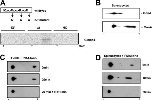 Figure 4. Functional analysis of Gimap4 motifs. (A) Gimap4 protein was produced in an in vitro TS/TL system. A pulldown of the protein with CaM beads in the absence (–) or presence (+) of Ca2+ was used to determine the binding capacity of CaM to Gimap4. A functional mutant (IQ*), where the 3 arginine residues (R) within the IQ domain were substituted for 3 glutamine residues (Q), failed to bind CaM. Furthermore, the empty vector was used as a negative control (NC). (B) Phosphorylation level of Gimap4 in the presence or absence of ConA (2 mg/mL). (C) Equal amounts of cell lysates from T cells treated with 10 ng/mL PMA plus 1 ng/mL ionomycin in the absence or presence of the PKC inhibitor rottlerin (1 mM) for 20 minutes were used for 2D gel analysis, and immunoblots were performed using anti-Gimap4 polyclonal antibody. Phospho-Gimap4 species are identified by a shift in the isoelectric point. In vitro inhibition of PKC activity abrogates phosphorylation of Gimap4. (D) Gimap4 phosphorylation diminishes after 60 minutes of PMA/ionomycin stimulation.