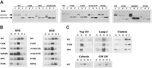 Figure 2. Disruption of subcellular localization of MT-HNE proteins in U937T cells. (A) Glycosylation of WT-HNE or MT-HNE in U937T cells. Whole cell lysates of U937T-WT-HNE or -MT-HNE cells after induction of transgene expression were incubated with endoglycosidase H (H) or N-glycosidase F (F) or without enzyme (control; C) and were analyzed by immunoblot using anti-HNE (29-34 kDa). Resistance to digestion by endoglycosidase H indicates that HNE has reached the medial Golgi compartment. (B) Presence of HNE protein (29-34 kDa) in subcellular fractions of U937T cell lysates obtained by differential centrifugation: P1 (nuclear and nuclear-associated proteins), P2 (mitochondria, lysosomes, ER), P3 (plasma membrane, secretory and other vesicles, Golgi complex), and S (soluble cytosolic proteins). TL indicates total cell lysate. (C) Localization of cellular marker proteins in subcellular fractions obtained by differential centrifugation for WT-HNE and the mutants V72M and S97L. The nuclear pore complex protein nup 153 (190 kDa) defines P1. Lamp-2 (120 kDa) is a lysosomal protein specifying the lysosomal fraction (P2). To characterize fractions P3 and S, clathrin (180 kDa), which may be membrane associated or soluble, was used. Fractionation of the ER and the Golgi complex were defined with the use of calnexin (90 kDa) and GM 130 (130 kDa).