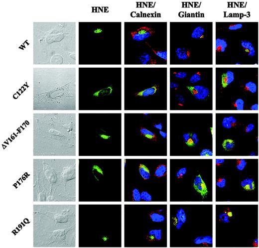 Figure 4. Mutations in ELA2 lead to cytoplasmic accumulation of MT-HNE proteins in transiently transfected HeLa cells. Subcellular localization of WT- or MT-HNE protein in HeLa cells. Cells were labeled with anti-HNE (green) and anticalnexin (ER marker; red), antigiantin (Golgi marker; red), and anti–lamp-3 (lysosomal marker; red). TO-PRO-3 was used to counterstain the nuclei (blue). Yellow displays colocalization of HNE protein with organelle-specific markers (Figures S1-S5).