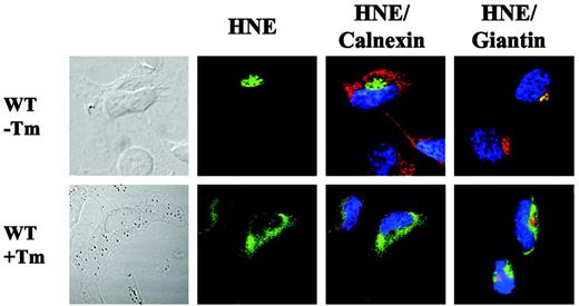 Figure 7. Cytoplasmic accumulation of WT-HNE in cells after ER stress induction. Subcellular localization of WT-HNE protein in HeLa cells with or without ER stress induction by tunicamycin (Tm). Cells were labeled with anti-HNE (green) and anticalnexin (ER marker; red) or antigiantin (Golgi marker; red). TO-PRO-3 was used to counterstain the nuclei (blue). Yellow represents colocalization of HNE protein with the organelle-specific markers.