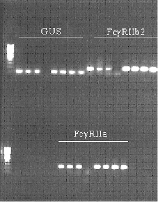 Figure 1. Validation of quantitative RT-PCR for FcγRII isoforms on the LightCycler. The products obtained in PCR were separated on 1% agarose gel. GUS, FcγRIIb2, and then FcγRIIa were loaded. The first 3 slots are the serial dilutions of the standard curve, followed by the nontemplate control, followed by duplicates of 2 samples.