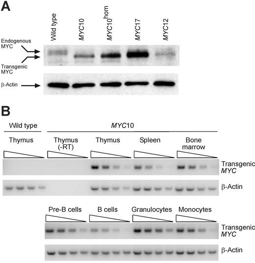 Figure 1. VavP-MYC lines with a range of transgene expression levels. (A) Differing expression levels of transgenic MYC protein in MYC17, MYC10, MYC10hom (homozygous for the transgene locus), and MYC12 mice. Western blot of thymocyte lysates prepared from healthy young transgenic and wild-type mice were probed with anti-MYC antibody. Note that expression of endogenous Myc (a slower-migrating, broad, phosphorylated band) is repressed in the transgenic samples. The same filter probed with anti–β-actin is shown as a loading control. (B) Widespread expression of transgenic MYC RNA in MYC10 mice. Semiquantitative RT-PCR analysis of RNA prepared from thymocytes, splenocytes, bone marrow cells, and sorted pre-B cells (B220+ IgM–), B cells (B220+ IgM+), monocytes (Mac1+ Gr1–), and granulocytes (Mac1+ Gr1+) from 8-week-old MYC10 mice. Analyses of RNA with the reverse transcription reaction omitted (–RT) confirms specificity of PCR primers for transgene-expressed MYC RNA. RT-PCR reactions from serial 5-fold dilutions of input RNA are shown. Analysis of endogenous β-Actin RNA is shown as a control.