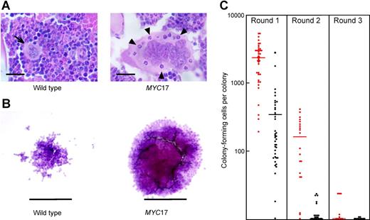 Figure 5. Abnormal hematopoiesis in VavP-MYC mice. (A) An abnormally large megakaryocyte in the bone marrow of a 4-week-old MYC17 mouse (right panel) containing internalized granulocytes (some indicated by arrowheads) and for comparison, a normal megakaryocyte (left panel; indicated by arrow) in the bone marrow of a wild-type littermate. H&E-stained sections; scale bar equals 20 μm. (B) Abnormally large macrophage colonies developed in M-CSF–stimulated cultures of MYC17 (right panel) and MYC10 (not shown) bone marrow cells when compared with cultures of wild-type cells (left panel); scale bar equals 125 μm. (C) Primary M-CSF–stimulated macrophage colonies from 8-week-old MYC17 (red) and wild-type (B6) mice were recultured in M-CSF (Round 1) and the colonies that developed were counted. Recloning was performed for 2 more successive rounds using colonies from the first and second rounds. Bars indicate the mean.