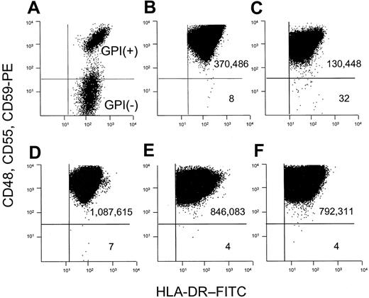 Figure 1. Flow cytometric dot plot analysis for the calculation of f and μ. BLCLs were analyzed after staining sequentially with a mixture of unconjugated anti–human CD48, CD55, and CD59, PE-conjugated rabbit anti–mouse immunoglobulin antibody, and anti-HLA-DR–FITC. The number of events is shown in each quadrant. The mutant frequency (f) is calculated as the number of GPI– cells divided by the number of GPI+ cells. (A) Normal GPI+ cells mixed with GPI– cells from a patient with PNH. (B) BLCLs from healthy donor 1, where the frequency of mutants is 22 × 10–6 (C) BLCLs from a patient with ataxia-telangiectasia, with increased GPI– cells (f = 245 × 10–6). (D-F) To calculate the mutation rate, preexisting mutants are eliminated from the population by collecting the upper 50th percentile of the distribution curve after staining with anti-CD59. The collected GPI+ cells are then returned to culture and expanded. The mutation rate is determined by the formula μ = f ÷ d, where d represents the number of cell divisions occurring in vitro after sorting.24 (D) Analysis of a BLCL from healthy donor 2 after expansion after flow sorting. f = 6.4 × 10–6, d = 8 cell divisions, and μ = 8 × 10–7 mutations per cell division. (E-F) Analyses of 2 representative cell lines from PNH patients. (E) Analysis of a BLCL from PNH patient 1 after expansion after flow sorting. f = 4.73 × 10–6, d = 4.24 cell divisions, and μ = 11.2 × 10–7 mutations per cell division. (F) Analysis of a BLCL from PNH patient 2 after expansion after flow sorting. f = 5.05 × 10–6, d = 10.6 cell divisions, and μ = 4.76 × 10–7 mutations per cell division.
