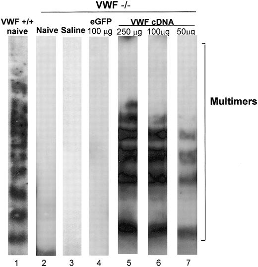 Figure 2. Western blot analysis of VWF multimers in plasma after tail vein administration of the murine VWF cDNA to VWF–/– mice. Murine VWF cDNA (100 μg) was administered to VWF–/– mice with saline as a negative control. After 48 hours, plasma was collected from mice that had received injections and was assessed by Western blot analysis. Relative gel positions of VWF multimer bands are indicated on the right. Lane 1, plasma of naive wild-type mice showing normal VWF multimer pattern; lane 2, plasma from naive VWF–/– mice showing the absence of VWF multimers; lane 3, plasma from VWF–/– mice 48 hours after administration of saline showing the monomer/dimer pattern; lane 4, VWF–/– mice 48 hours after administration of 100 μg eGFP cDNA showing the absence of VWF multimers; lane 5, plasma from VWF–/– mice 48 hours after administration of 250 μg VWF cDNA; lane 6, plasma from VWF–/– mice 48 hours after administration of 100 μg VWF cDNA; lane 7, plasma from VWF–/– mice 48 hours after administration of 50 μg VWF cDNA. Lanes 5 to 7 reveal a VWF pattern similar to that seen in WT mice.