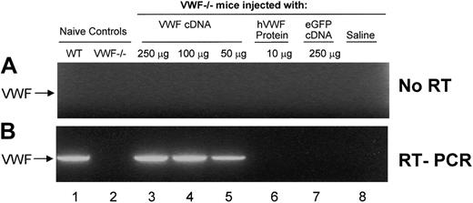 Figure 3. Evaluation of liver-specific VWF expression by RT-PCR after hydrodynamic injection of VWF cDNA. Analysis was carried out on total RNA from liver with VWF-specific primers (forward, 5′-GGACATTTTCTCAGACCACCATA-3′; reverse, 5′-TGTGGAGGCTGAGTTGGG-3′) 48 hours after hydrodynamic injection with murine VWF cDNA. To demonstrate that VWF RNA and not plasmid DNA was amplified, control reactions were performed without the addition of (A) reverse transcriptase. The lower panel shows identical reactions with (B) reverse transcriptase included. Lane 1, RT-PCR of RNA from untreated WT mice; lane 2, RT-PCR of RNA from untreated VWF–/– mice; lane 3, RT-PCR of RNA from VWF–/– mice 48 hours after hydrodynamic injection of 250 μg murine VWF cDNA; lane 4, RT-PCR of RNA from VWF–/– mice 48 hours after hydrodynamic injection of 100 μg murine VWF cDNA; lane 5, RT-PCR of RNA from VWF–/– mice 48 hours after hydrodynamic injection of 50 μg murine VWF cDNA; lane 6, RT-PCR of RNA from VWF–/– mice 48 hours after hydrodynamic injection of 10 μg recombinant human VWF protein (rhVWF; negative control); lane 7, RT-PCR of RNA from VWF–/– mice 48 hours after hydrodynamic injection of 250 μg eGFP cDNA (negative control); lane 8, RT-PCR of RNA from VWF–/– mice 48 hours after hydrodynamic injection of saline (negative control). Using the described primers, the RT-PCR product of VWF mRNA is a 2.2-kb band, marked by an arrow in the left of both panels. RT-PCR products were visualized on ethidium bromide agarose gels.