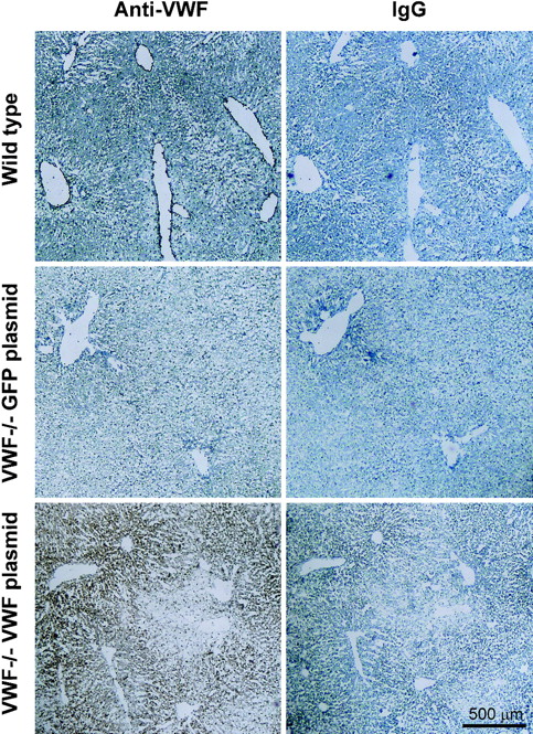 Figure 4. Immunohistochemical localization of VWF expression in liver sections from VWF–/– mice after intravenous administration of murine VWF cDNA. Data are presented pairwise. Sections on the left were stained with a specific anti-VWF antibody, and sections on the right (controls) were treated with an irrelevant antibody (rabbit IgG). (A) Naive wild-type C57BL/6 mouse stained with rabbit anti–human VWF antibody. Dense endothelial staining of VWF is observed. (B) Same as upper left but stained with rabbit IgG (control). (C) Liver, VWF–/–, 48 hours after administration of 250 μg eGFP cDNA plasmid (negative control), anti–human VWF antibody. (D) Same as middle left, control antibody. No staining is observed in either sample. (E) Liver, VWF–/– mouse, 48 hours after administration of 250 μg VWF cDNA plasmid, anti–human VWF antibody. (F) Same as lower left, control antibody; strong diffuse staining is observed within the liver parenchyma. Bar represents 500 μm.
