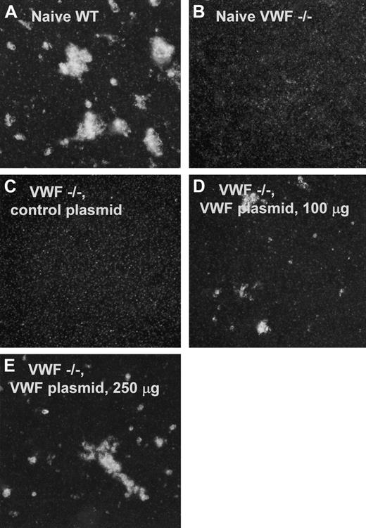 Figure 5. Stimulated aggregation of murine platelets by plasma from wild-type or VWF–/– mice. Platelet aggregation was assessed by mixing platelet-rich plasma (PRP), test plasma, and botrocetin. Photographs were taken after 2 hours; 23°C with gentle rocking. (A) Naïve WT. PRP from VWF wild-type mice, mixed with plasma from VWF wild-type mice containing natural endogenous VWF (positive control) showing aggregation. (B) Naive, VWF–/–. PRP from VWF–/– mice mixed with plasma from naive VWF–/– mice and botrocetin (negative control), illustrating the absence of functional VWF from the plasma of VWF–/– mice. (C) VWF–/–, control plasmid. PRP from VWF–/– mice mixed with plasma from VWF–/– mice that had received 100 μg irrelevant cDNA (negative control) showing no aggregation. (D) VWF–/–, VWF plasmid, 100 μg. PRP from VWF–/– mice mixed with plasma from VWF–/– mice that had received 100 μg VWF cDNA shows botrocetin-stimulated aggregation of platelets indicating the presence of functional gene transfer–derived VWF. (E) VWF–/–, VWF plasmid, 250 μg. PRP from VWF–/– mice mixed with plasma from VWF–/– mice that had received 250 μg VWF cDNA shows increased botrocetin-stimulated aggregation of platelets, indicating the presence of functional gene transfer–derived VWF.