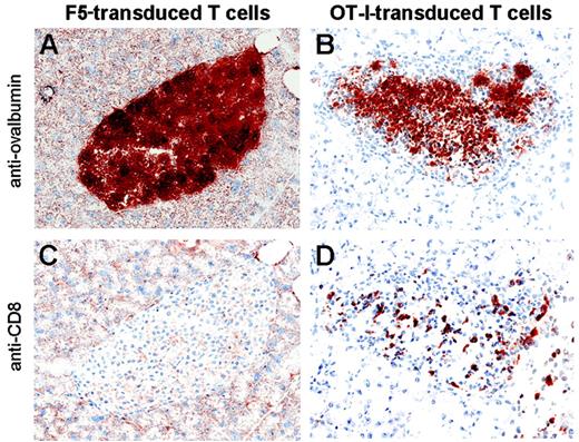Figure 4. Homing of TCR-transduced T cells to self-antigen–expressing peripheral tissue. RIP-OVAhi mice received 1 × 105 F5 (left) or OT-I (right) transduced T cells followed by inflova infection. Pancreatic islet infiltration by CD8+ cells and islet integrity were determined on day 7. Immunohistochemical analysis for ovalbumin (top) or CD8 (bottom) is shown. Original magnification, ×20.