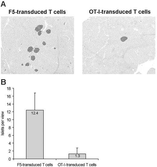 Figure 5. Destruction of ovalbumin-expressing β cells by TCR-transduced T cells. RIP-OVAhi mice received 1 × 106 F5 (left) or OT-I (right) transduced T cells followed by rVV-OVA infection. Mice were treated with insulin implants upon onset of diabetes, and pancreata were harvested 3 months after transfer. Three nonserial sections per mouse were assessed for ovalbumin-positive islands by immunohistochemistry. Per section, the number of islets per view was counted using ×2.5 magnification. Shown are (A) 2 representative sections and (B) the average numbers of islets per view for mice that received F5 or OT-I TCR-transduced T cells. Original magnification, ×5.