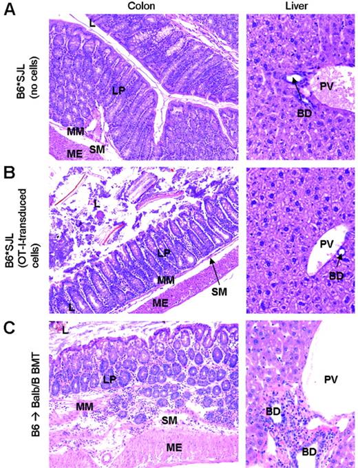 Figure 7. TCR-transduced T cells do not induce graft versus host pathology in partially MHC-mismatched recipients. Colon and liver sections were obtained either 6 weeks after viral infection (A-B) or at the onset of clinical GvHD (C). L indicates lumen; LP, lamina propria; MM, muscularis mucosae; SM, submucosa; ME, muscularis externa; BD, bile duct; PV, portal vein. Lymphocytic infiltrates are present throughout the intestinal wall and in the periportal area of Balb.B recipients (C), whereas intestine and periportal area of partially MHC-mismatched recipients are unaffected (A-B). Original magnification, ×16 (A-B, left panels); ×32 (A-B, right panels); ×125 (C, left panel); and ×20 (C, right panel).